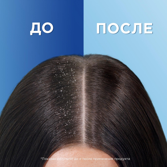 Шампунь «Head&Shoulders» 2 в 1, цитрусовая свежесть, 400 мл