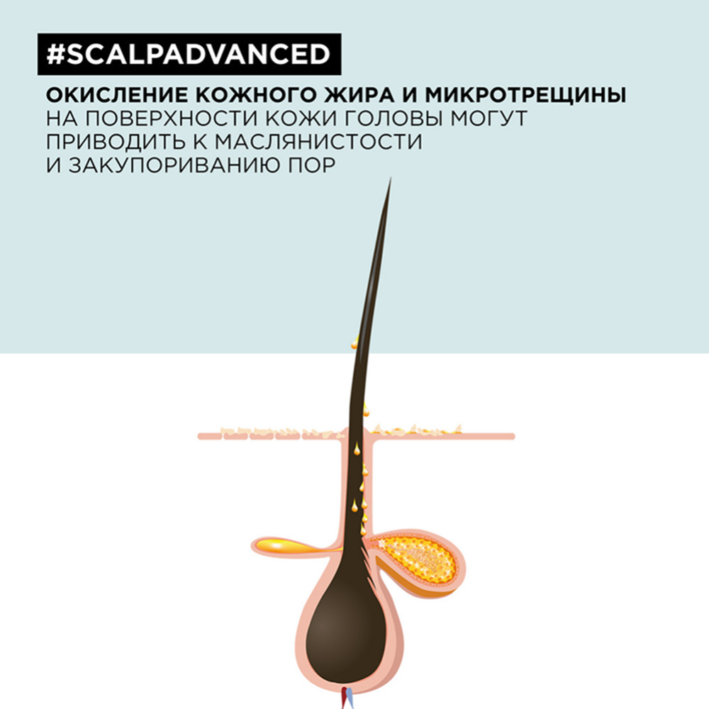 Шампунь для волос «L'Oreal Professionnel» Serie Expert, Scalp Advanced, очищающий, 300 мл