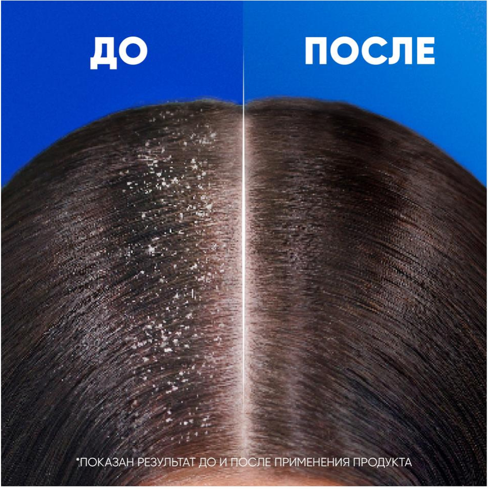 Шампунь «Head&Shoulders» основной уход, 800 мл #5