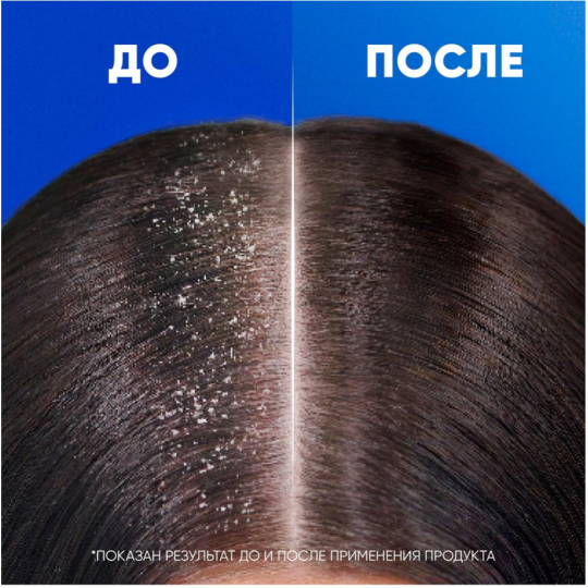 Шампунь «Head&Shoulders» 2 в1, основной уход, 1000 мл